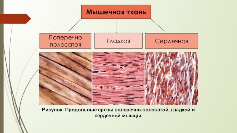 Отличия гладкой мускулатуры от поперечно полосатой. Поперечно сердечная мышечная ткань строение. Строение поперечно полосатой мышечной ткани гистология. Поперечнополосатая сердечная мышечная ткань гистология. Поперечно полосатая гладкая и сердечная ткань это.