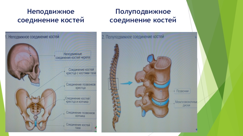 Полуподвижные кости человека