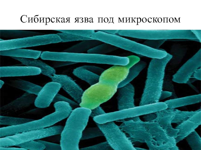 Сибирская язва под микроскопом