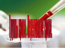 Презентация по биологии на тему Группы крови. Переливание крови
