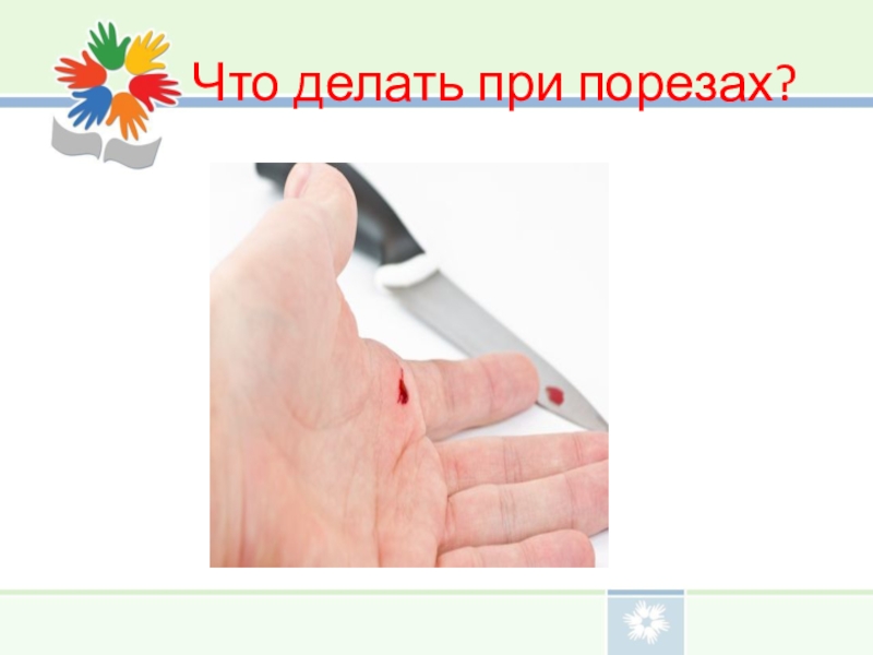 Что делать 21. Что деоать при порещак альца. Что надо делать при порезе. Что делать при порезе пальца.