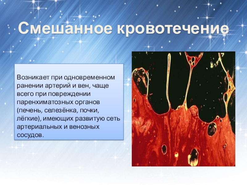 Смешанное кровотечение. Сиешанноекровотечение. Смещенное кровотечение. Опасность смешанного кровотечения.