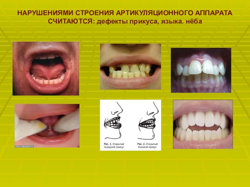 Речевой аппарат презентация