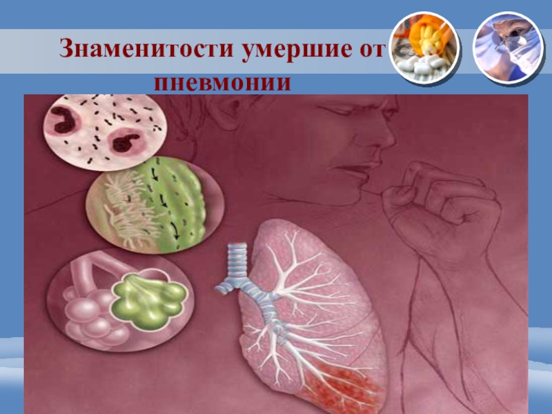 От пневмонии умирают. Смерти от воспаление лёгких. Осложнения пневмонии. От воспаления легких.