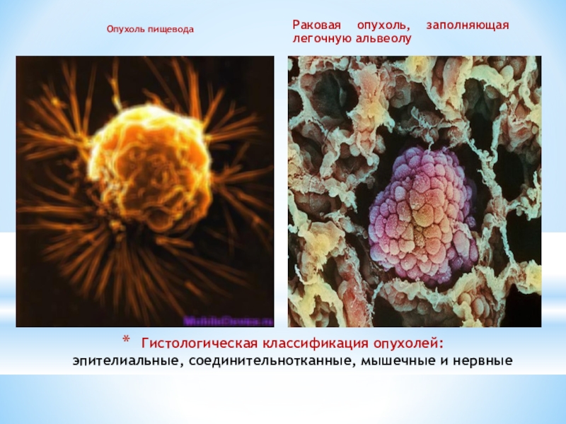 Презентация на тему опухоль