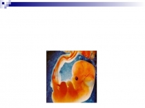 Презентация по биологии на тему Наследственные болезни человека (10 класс)