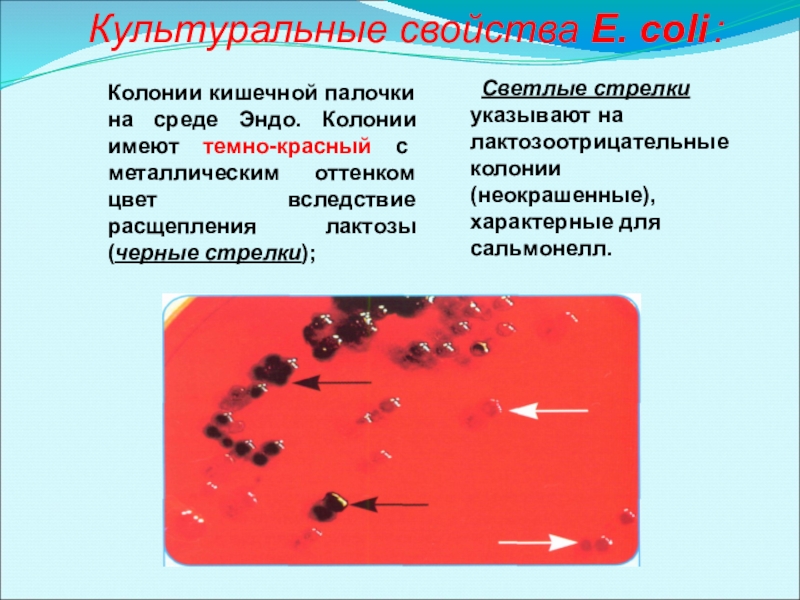 Свойства колонии. Колонии сальмонелл на среде Эндо. Колонии кишечной палочки. Колонии кишечной палочки на среде. Колонии кишечной палочки на среде Эндо.