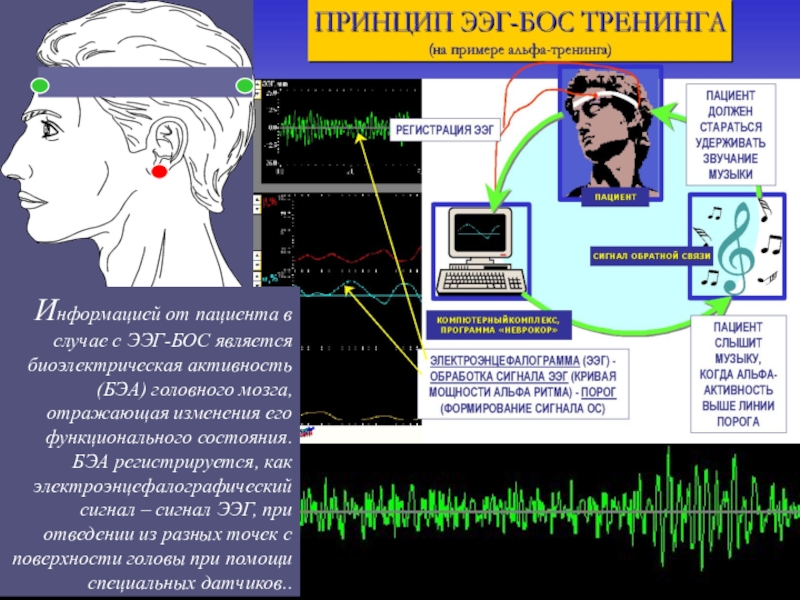 Для чего девушке филологу нужен был электроэнцефалограф. Электроэнцефалография принцип метода. Электроэнцефалографическое биоуправление. ЭЭГ бос. Принцип метода ЭЭГ.