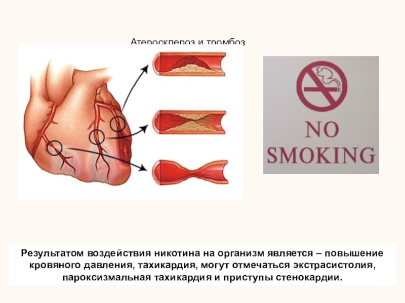 Организмом в результате в организм. Влияние никотина на кровеносные сосуды. Влияние никотина на сердечно сосудистую систему. Влияние курения на кровеносную систему человека. Воздействие никотина на сосуды.