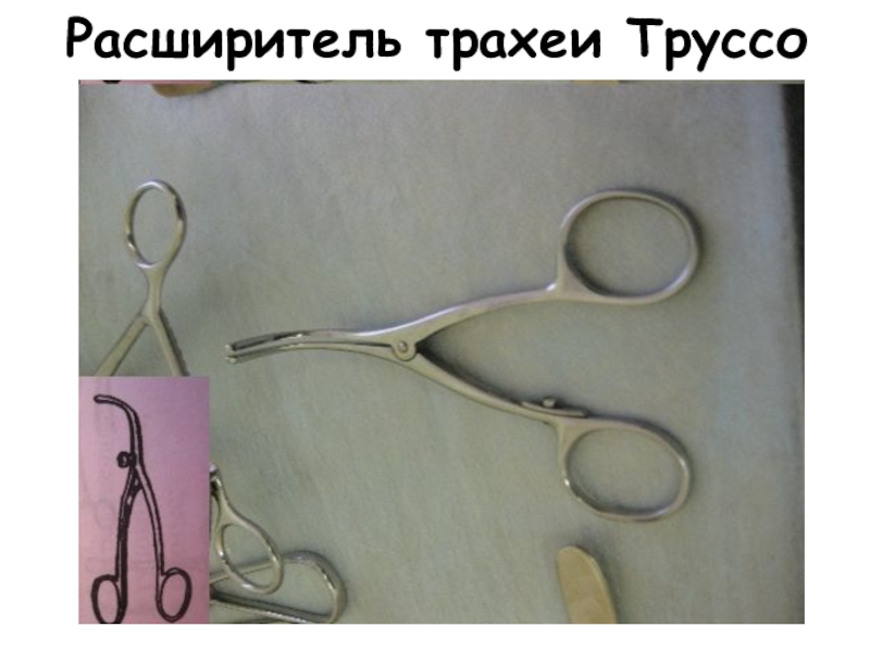 Ранорасширитель труссо фото