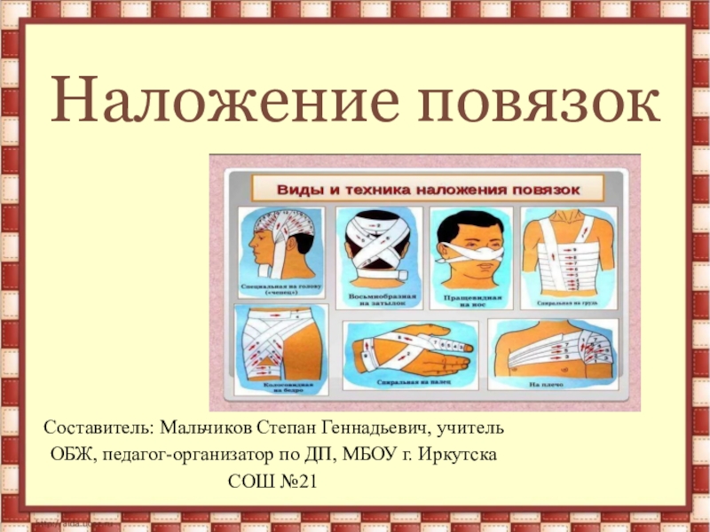 Виды наложения. Способы наложения повязок. Виды повязок ОБЖ. Перевязки ОБЖ. Типы перевязок ОБЖ.