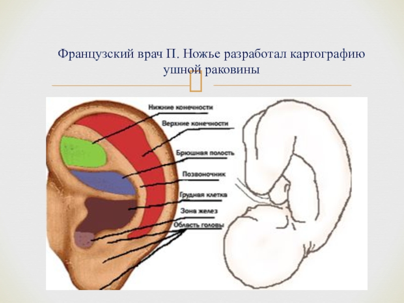 Проекция внутренних органов на ушной раковине рисунок