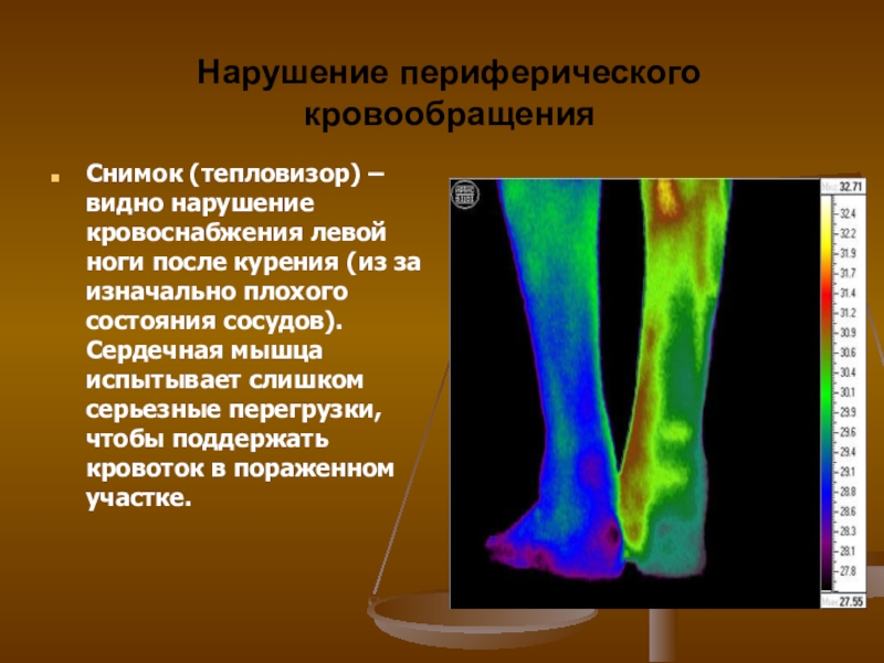 Нарушение периферического венозного кровообращения