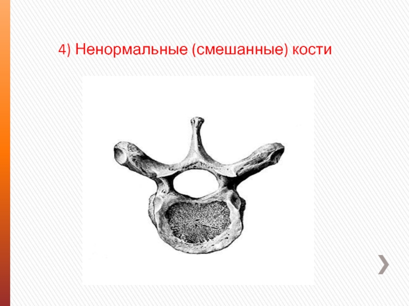 Смешанные кости. Смешанные кости человека строение. Смешанные кости строение рисунок. Ненормальные смешанные кости. Ненормальная смешанная кость.