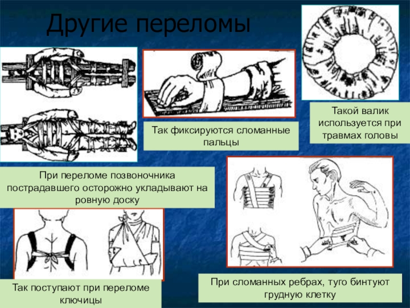 Первая помощь биология 8 класс. Первая помощь при травмах АДС. Оказание первой помощи при повреждении скелета. Помощь при травмах ОДС. Первая помощь при повреждении ОДС.