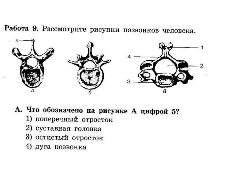 Позвонок рисунок. Строение позвоночника рис 28. Позвонок рисунок с обозначениями. Рассмотрите рисунки позвонков человека. Строение позвонка рис 19.