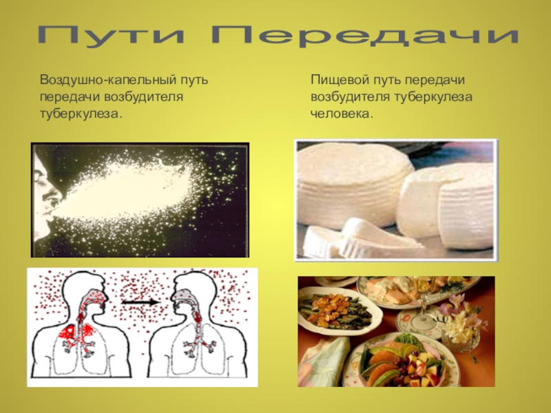 Пищевой путь. Алиментарный путь передачи туберкулеза. Аэлиментарный путем передачи туберкулеза. Пищевой путь передачи туберкулеза. Пути передачи микобактерий туберкулеза.