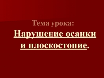 Презентация по биологии на тему Нарушение осанки и плоскостопие (8 класс)