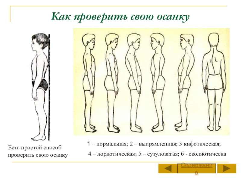 Рассмотрите рисунки 1 4 на каком из них изображен подросток с нормальной осанкой