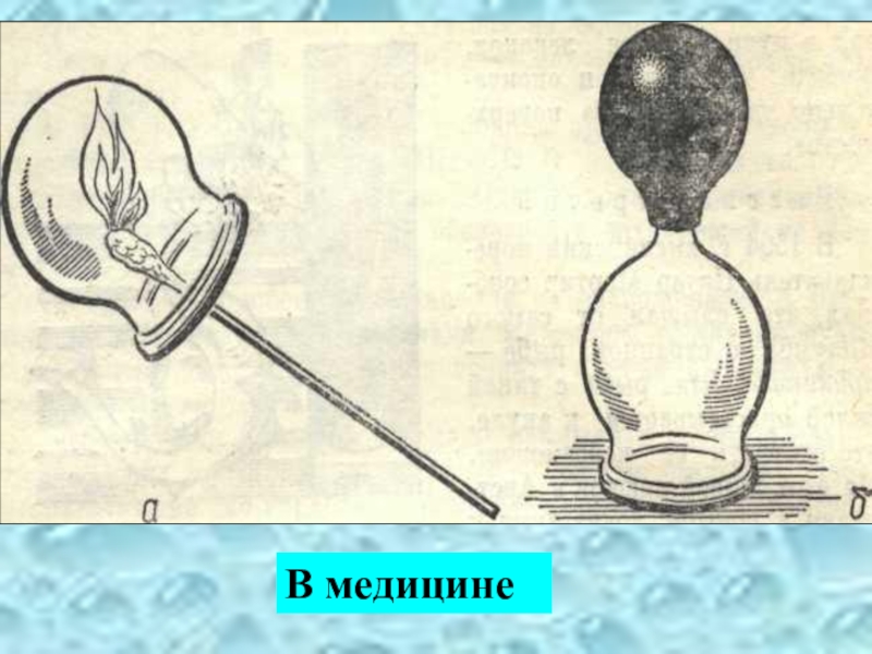 Применение давления. Атмосферное давление в медицине. Использование атмосферного давления. Использование атмосферного давления в медицине. Опыт с пипеткой атмосферное давление.