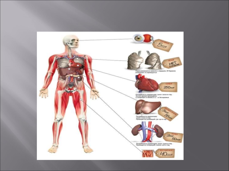 Сколько стоят органы человека. Трансплантация органов презентация. Пересадка органов и тканей презентация. Источники донорских органов.