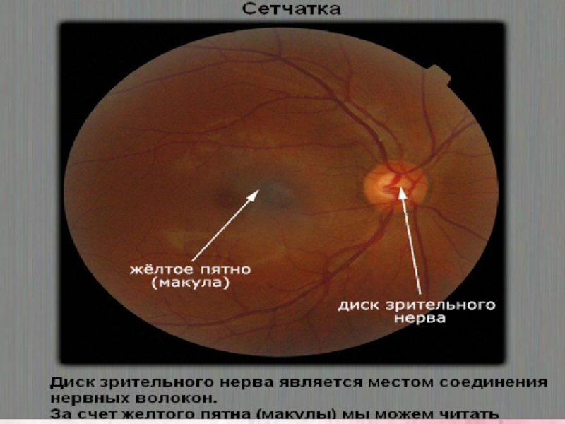Норма зрительного нерва. Макула и диск зрительного нерва. Диск зрительного нерва анатомия.
