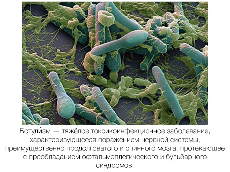 Ботулизм микробиология презентация