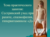 Презентация урока Рахит, спазмофилия, гипервитаминоз Д
