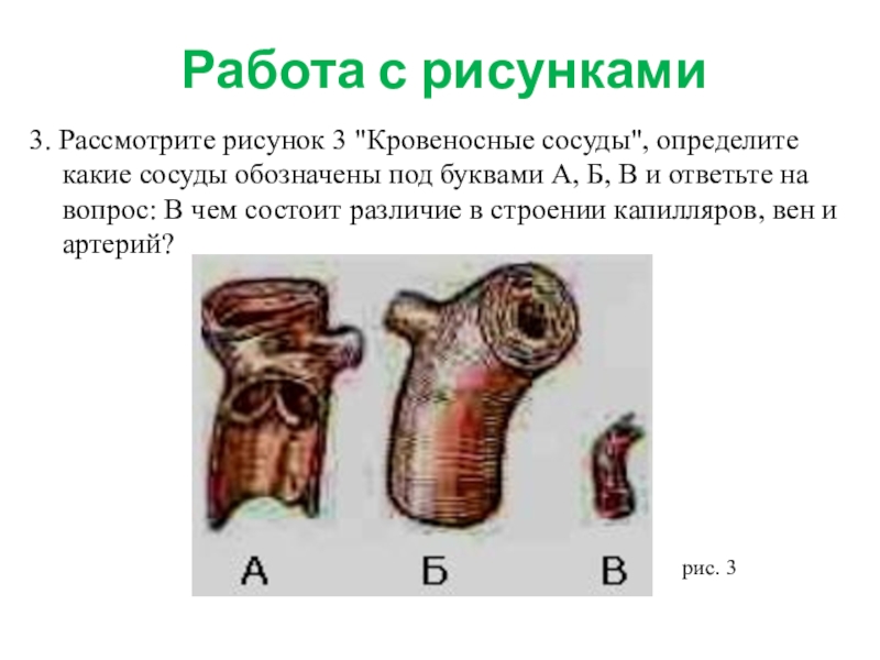 Рассмотрите рисунок с изображением повреждений кровеносных сосудов какой сосуд поврежден на нижнем