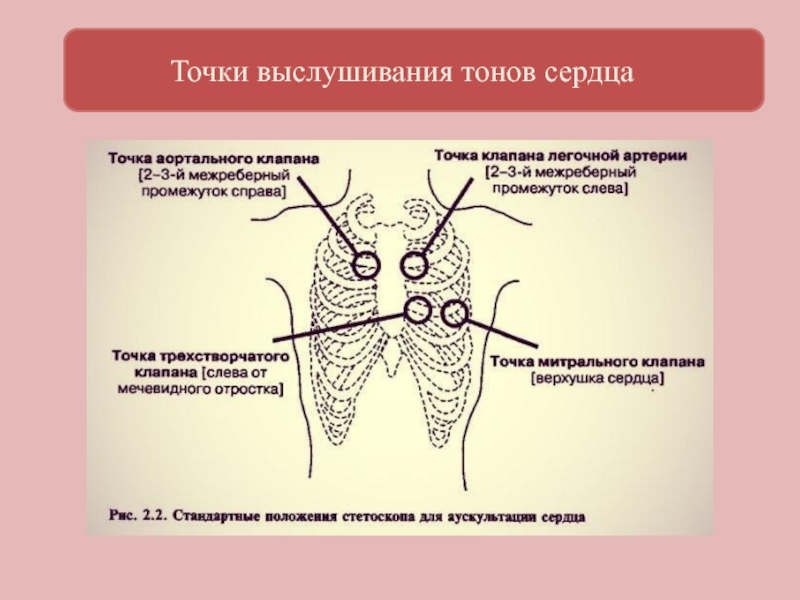 Шум остина флинта выслушивается в точке обозначенной на рисунке цифрой