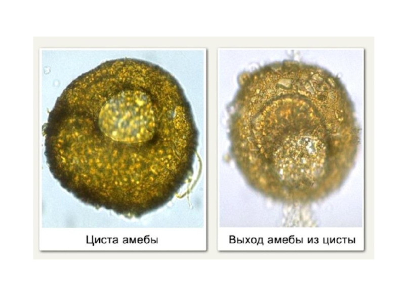 Циста это. Циста одноклеточных. Циста амебы. Цисты амёбы. Образование цист у амебы.