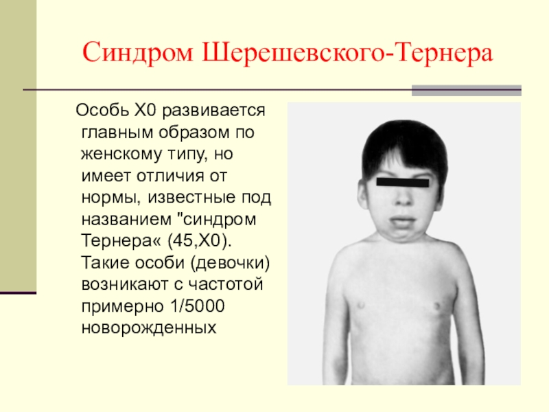 Синдром Шерешевского-Тернера  Особь X0 развивается главным образом по женскому типу, но имеет отличия от нормы, известные