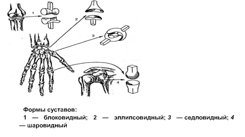 На рисунке изображен сустав