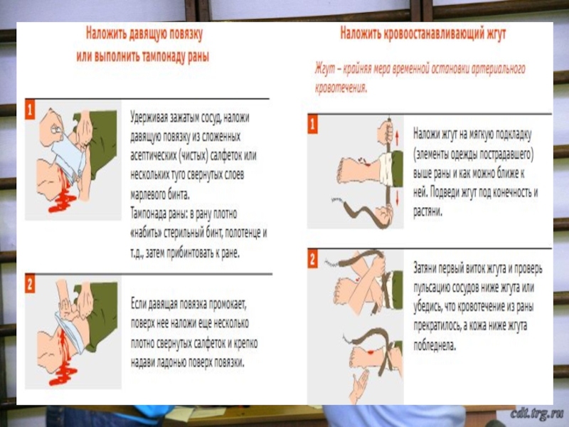 Тест по оказанию 1 помощи. Порядок наложения жгута и давящей повязки. Порядок наложения давящей повязки и кровоостанавливающего жгута. Правила наложения жгута и давящей повязки. Наложение давящих повязок жгута алгоритм.