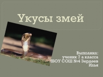 Презентация по ОБЖ на тему Укусы змей