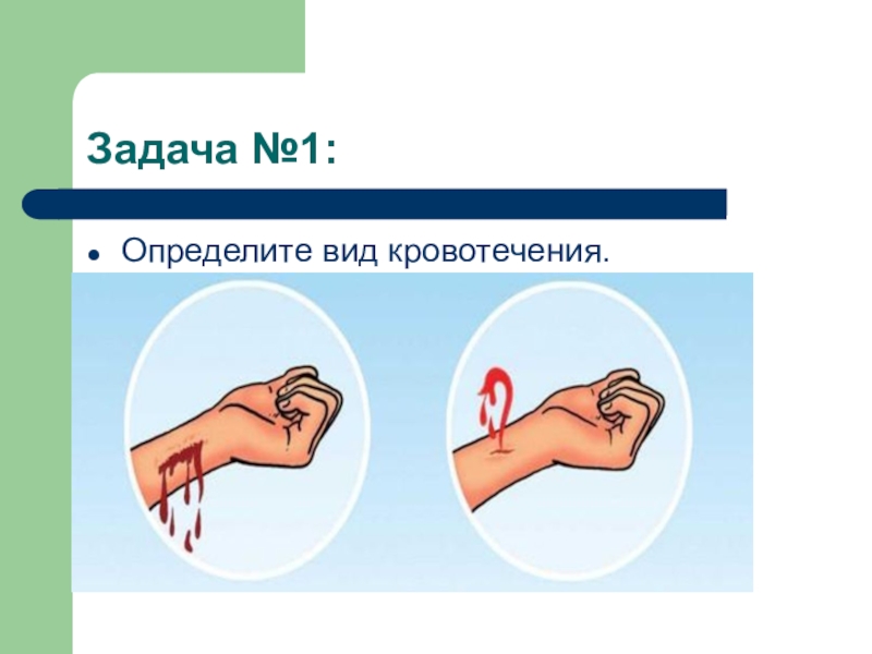 Первая помощь при различных видах повреждений 5 класс обж презентация и конспект