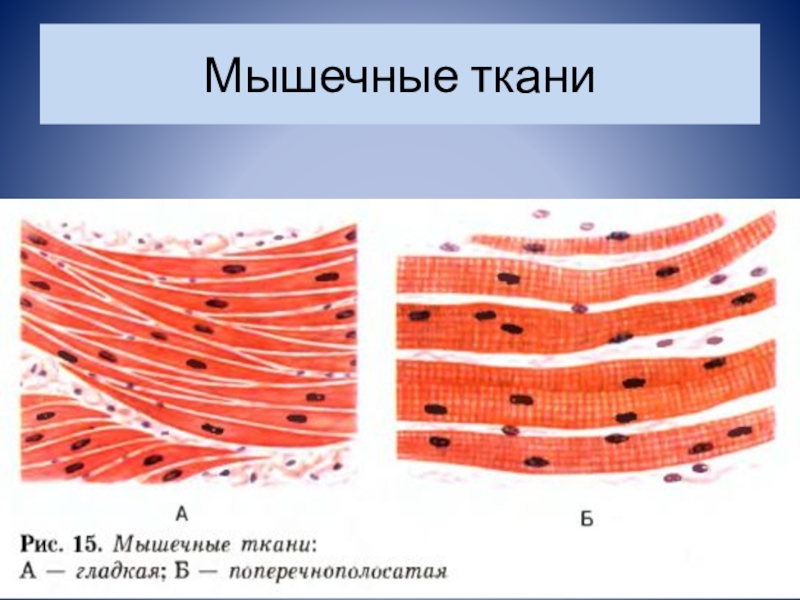 Поперечная клетка. Клетки поперечно-полосатой мышечной ткани. Гладкая мышечная ткань 8 класс биология. Клетка поперечнополосатой мышечной ткани. Клетки поперечно полосатой мышцы.