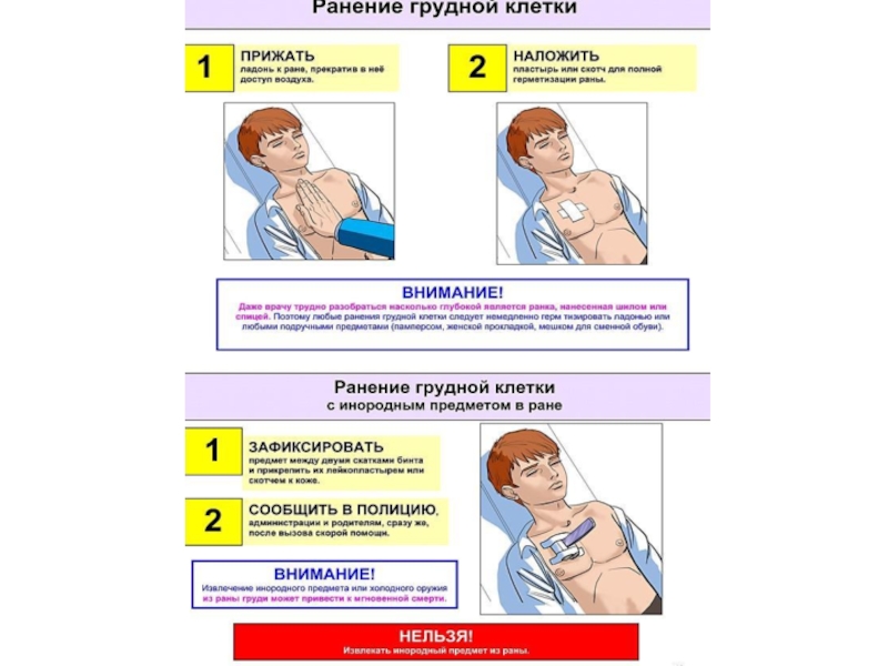 Проникающее ранение грудной. Оказание первой помощи при ранении грудной клетки. Оказание первой помощи при травме грудной клетки. Порядок оказания первой помощи при травме грудной клетки. Первая помощь при повреждении грудной клетки.