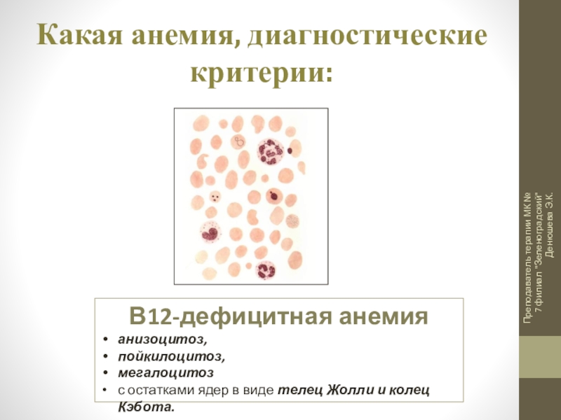 Презентация на тему сестринский уход при анемии