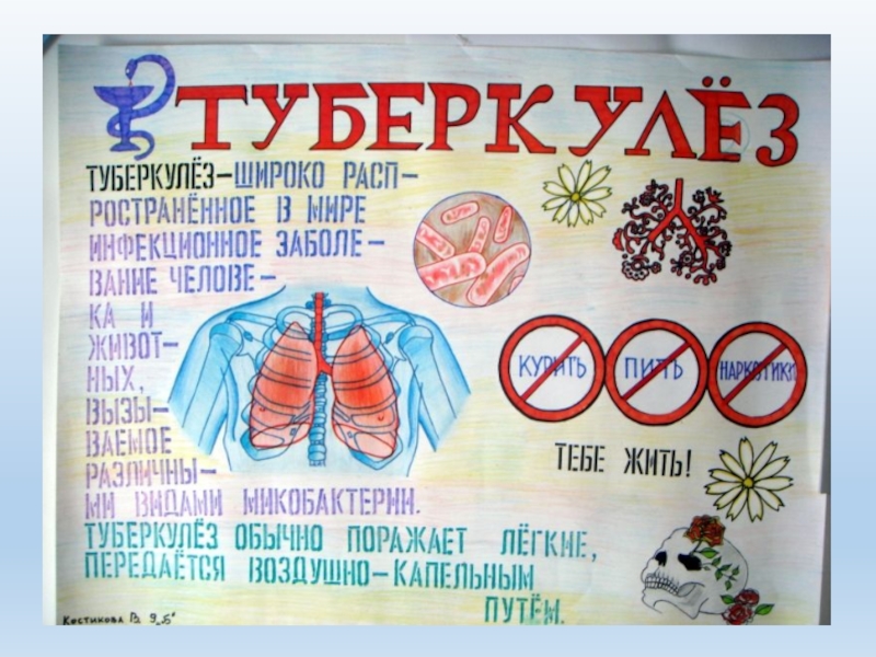 Стенд туберкулез