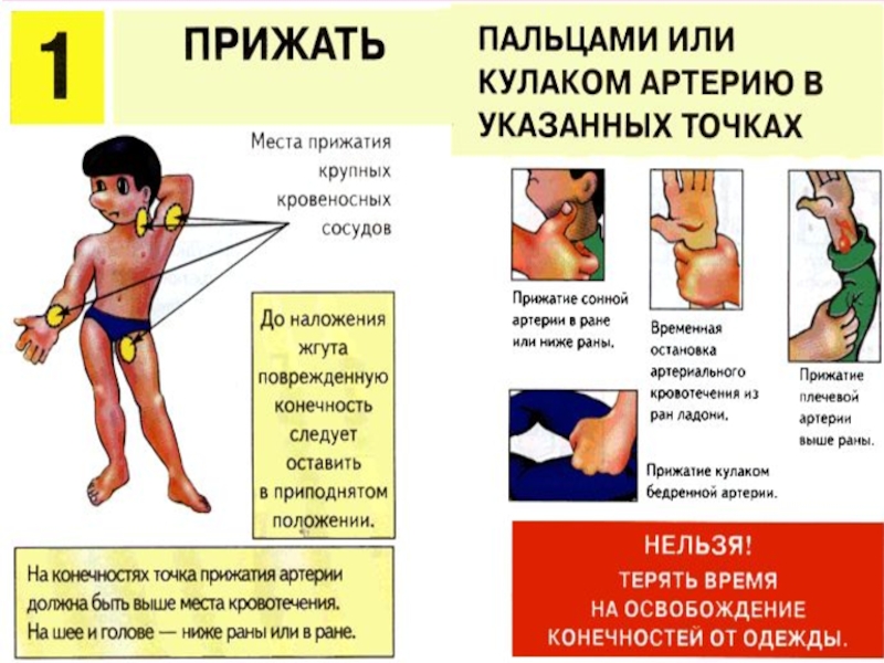 Пальцевое прижатие при повреждении бедренной артерии. Точки прижатия артерий при артериальном кровотечении. Места прижатия артерий при кровотечениях. Места прижатия артерий для остановки кровотечения. Точки прижатия артерий для остановки артериального кровотечения.