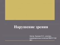 Доклад на тему: Нарушение зрения