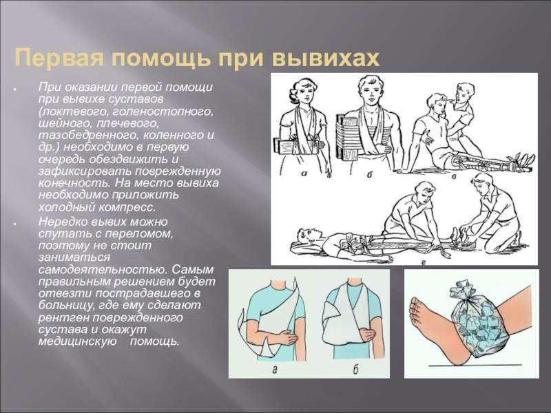 Используя приведенный перечень буквами обозначьте на схеме порядок медицинской помощи при вывихе