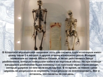 Урок по биологии. Типы соединения костей