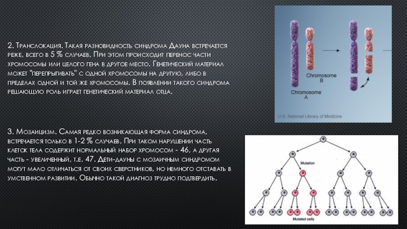 синдром дауна с транслокацией