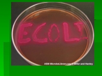 Презентация по биологии Бактерии E.Coli