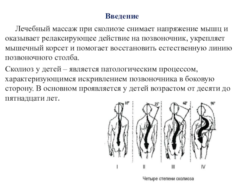 Схема массажа при сколиозе