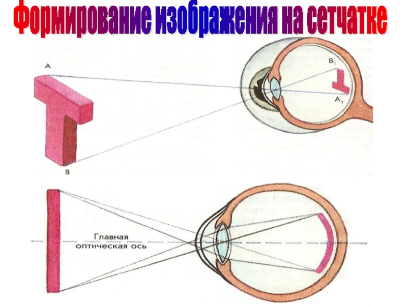 На сетчатке глаза изображение предмета