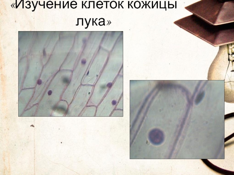 Изучение кожицы чешуи. Клетку лука кожицы лука. Клетки кожицы лука окрашенные йодом. Клетки кожицы чешуи лука. Микропрепарат клеток кожицы чешуи лука.