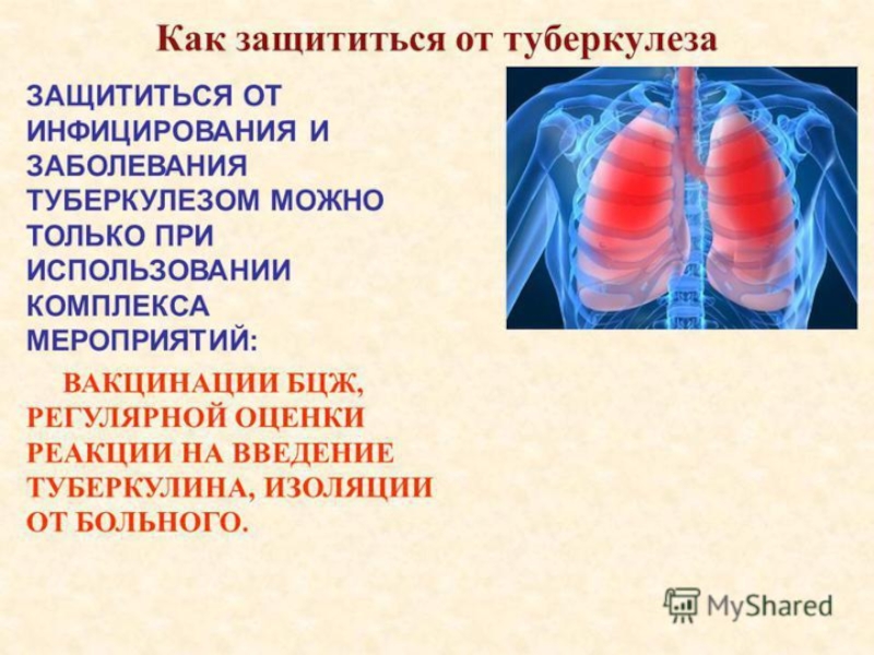 Проект туберкулез 9 класс